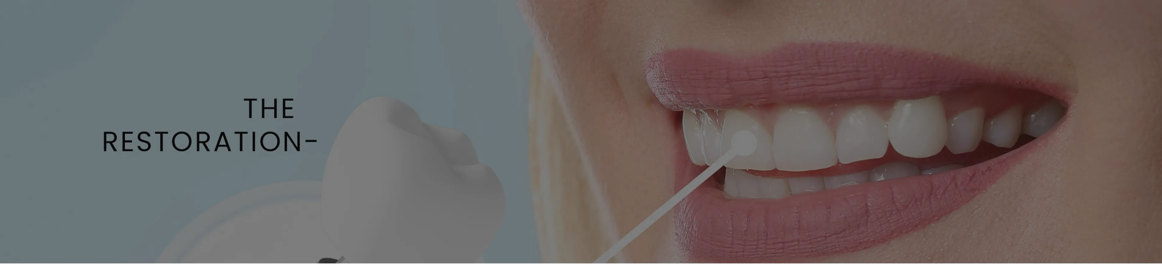 Close-up of a patient's smile during a dental restoration procedure