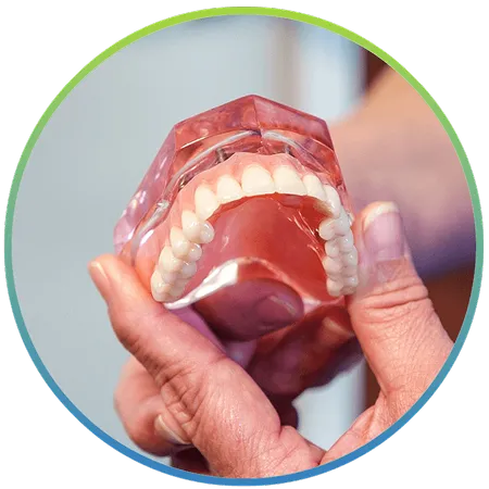 Full arch dental implant model