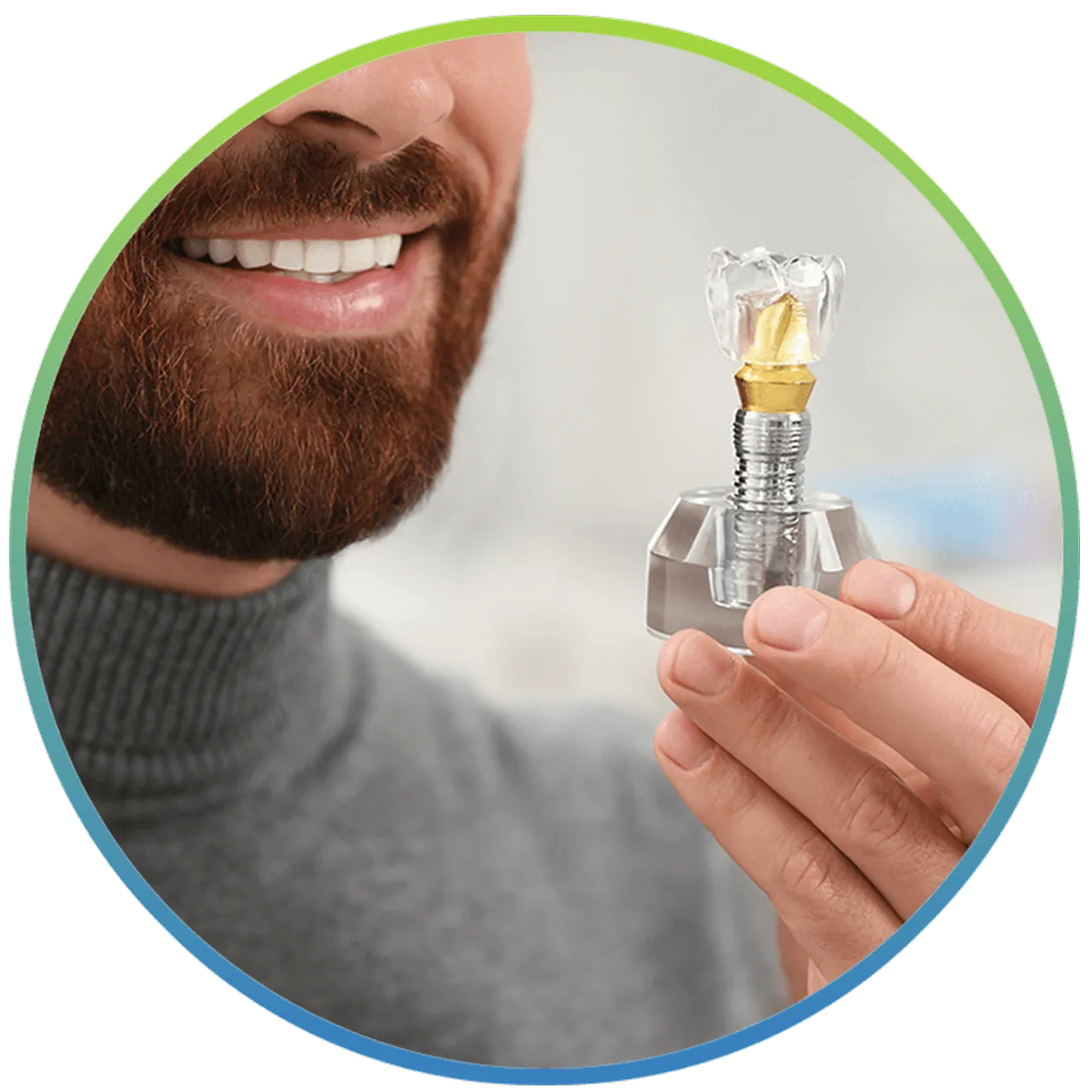 Full arch dental implant model